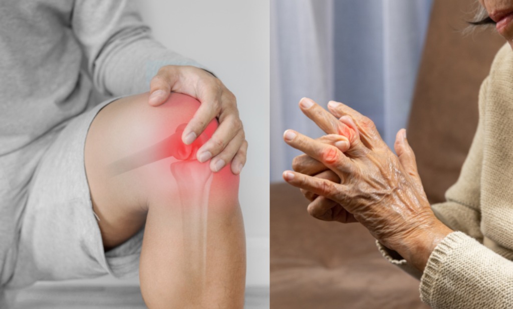 Osteoarthritis And Rheumatoid Arthritis